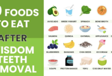 foods to eat after wisdom teeth removal