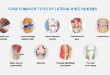 knee pain when bending