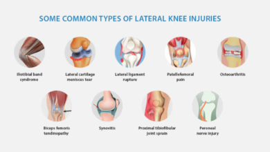 knee pain when bending
