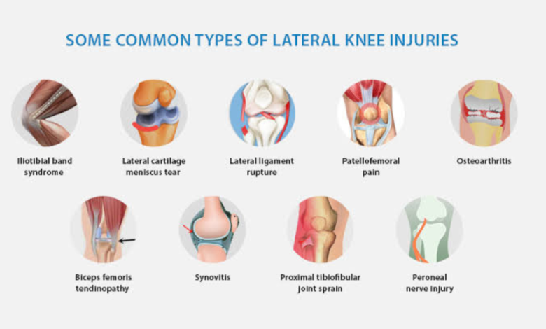 knee pain when bending